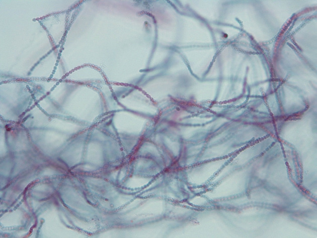 Anabaena Slides - Anabaena 11 400X
